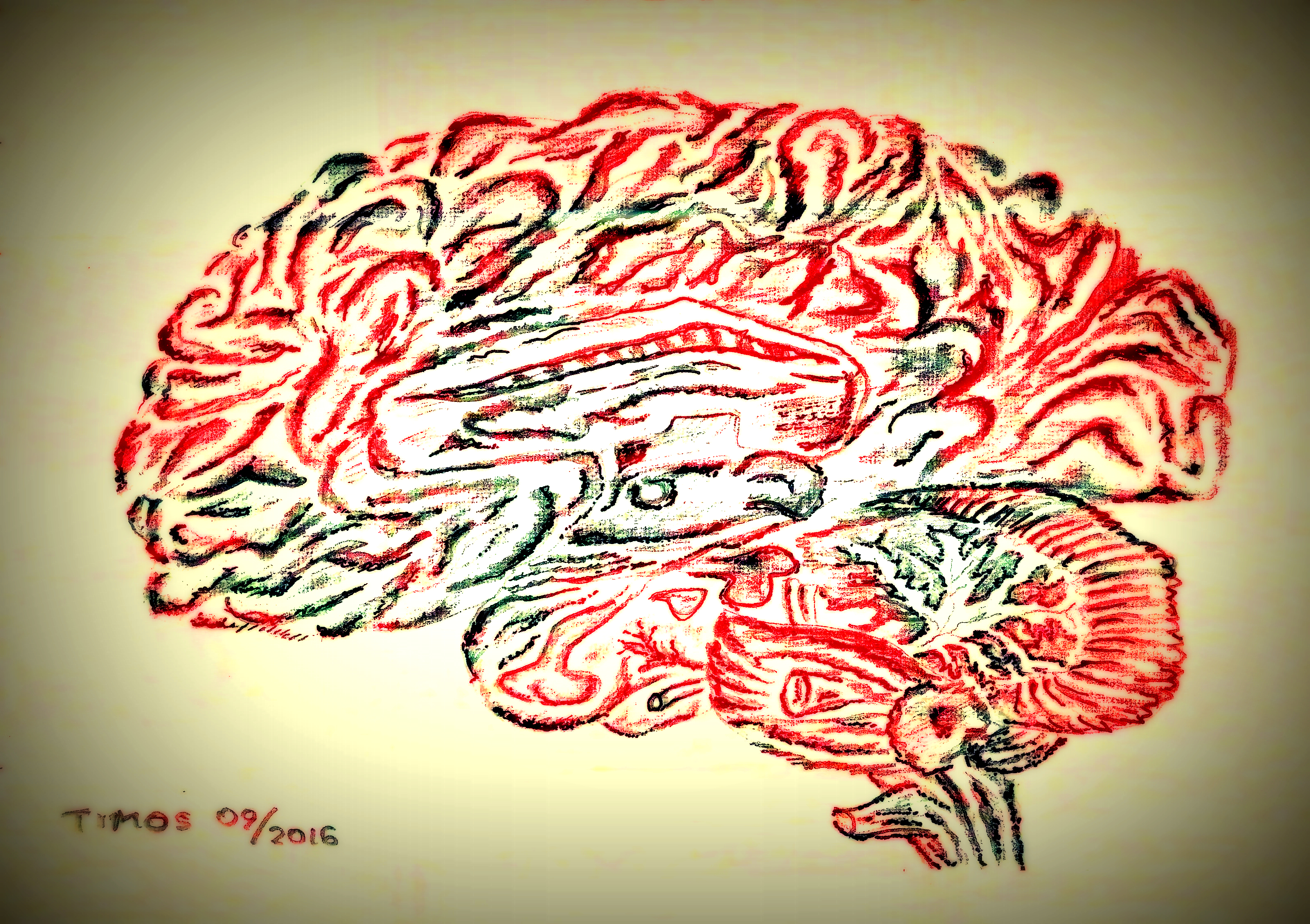 Brain, anatomical (6)