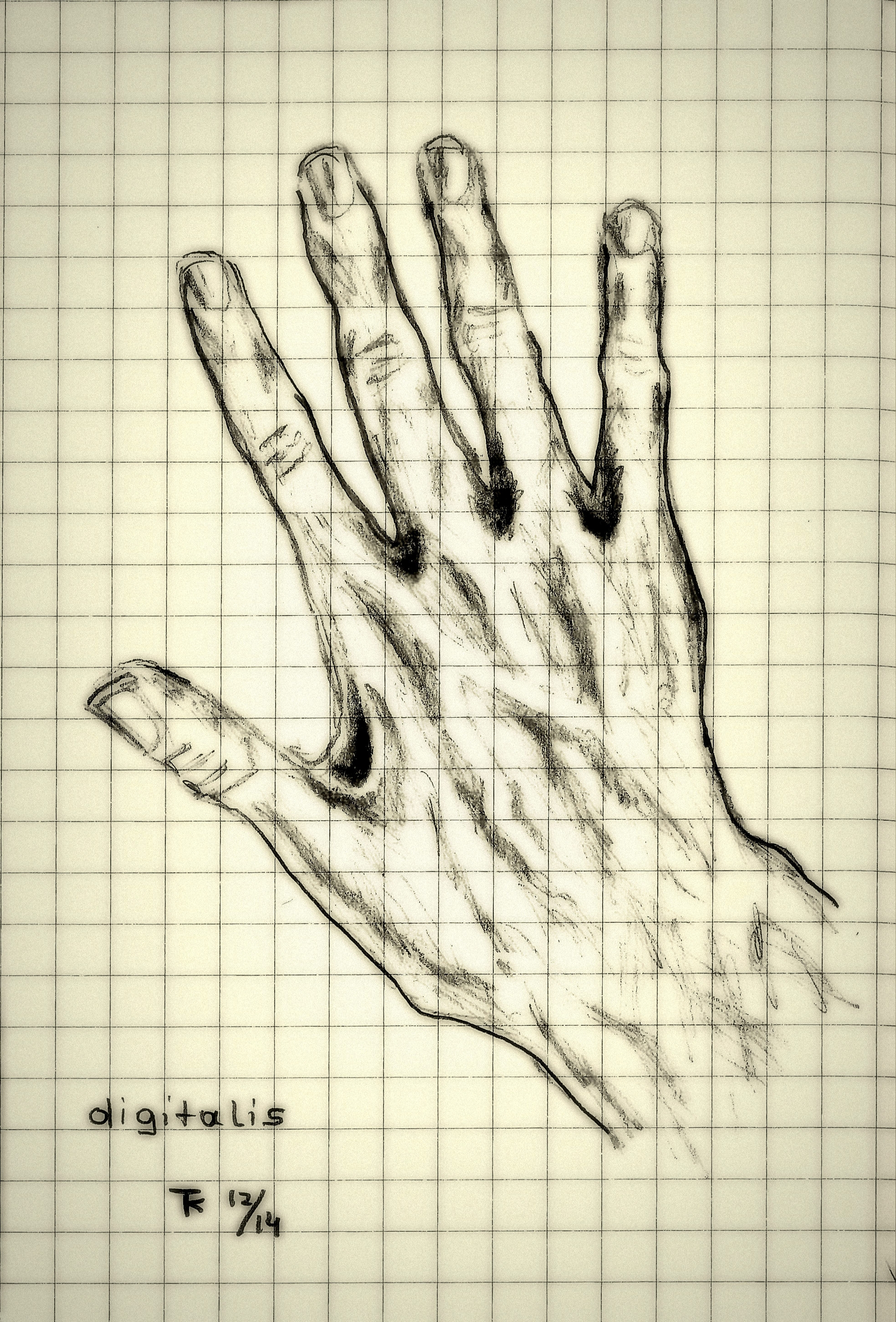 hand digitalis