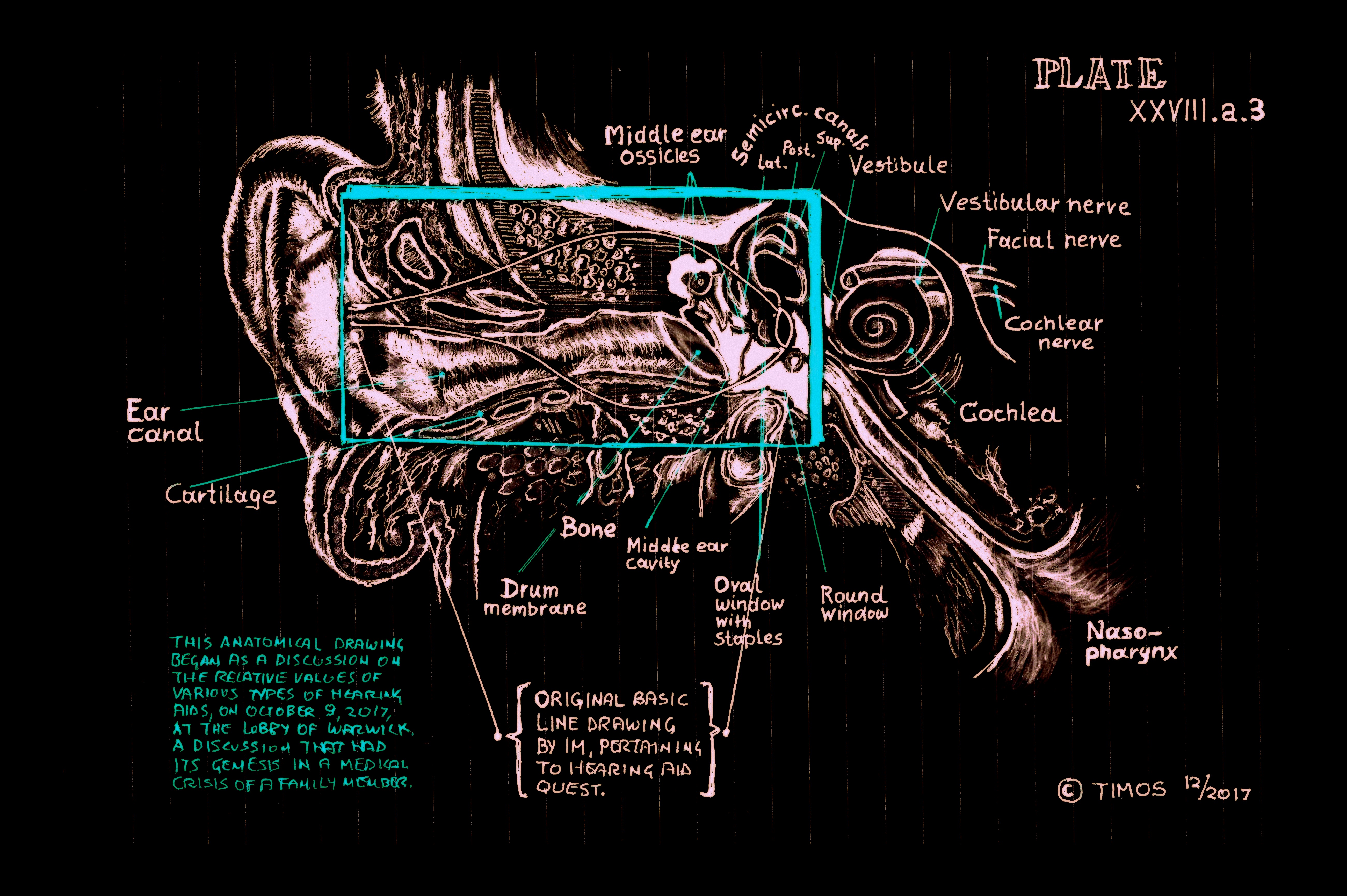 inner ear findings